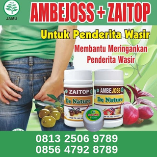 Illustration for article titled cara mengobati ambeien saat hamil secara alami